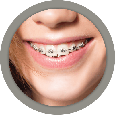 Fixed Orthodontics